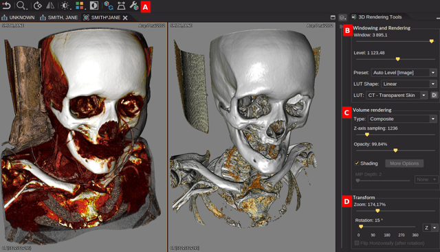 Official Weasis tutorial image showing 3D volume views and rendering tools; not verified as the latest Mac build.