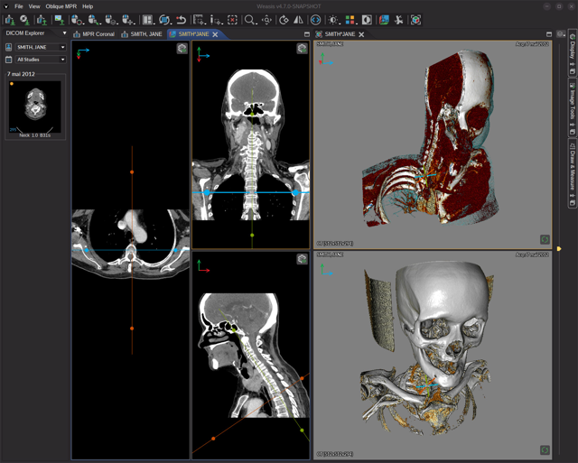 Espacio de trabajo oficial del visor DICOM Weasis (README del repositorio de origen).